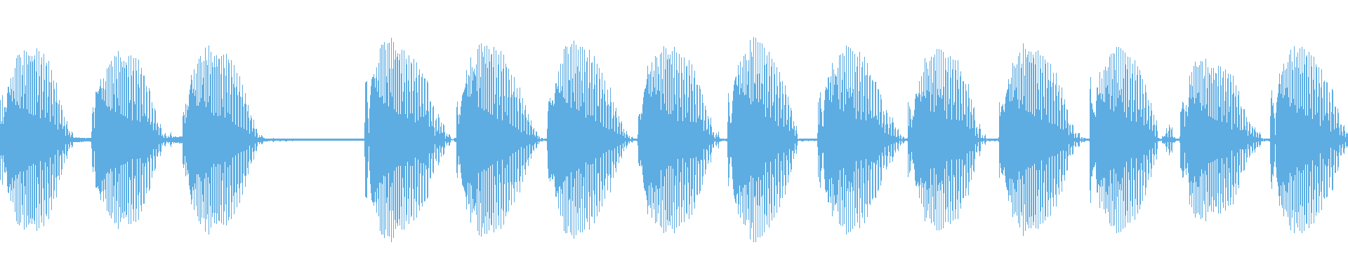 Waveform