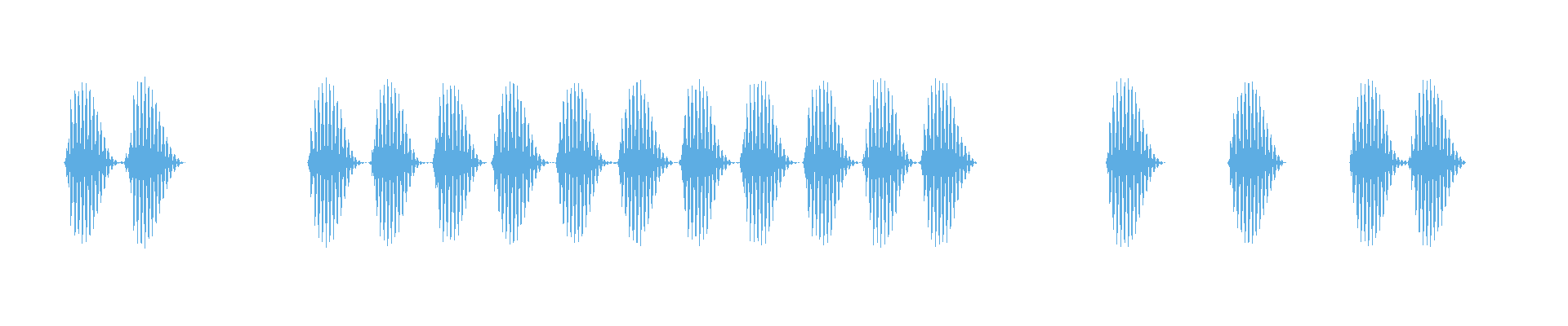 Waveform