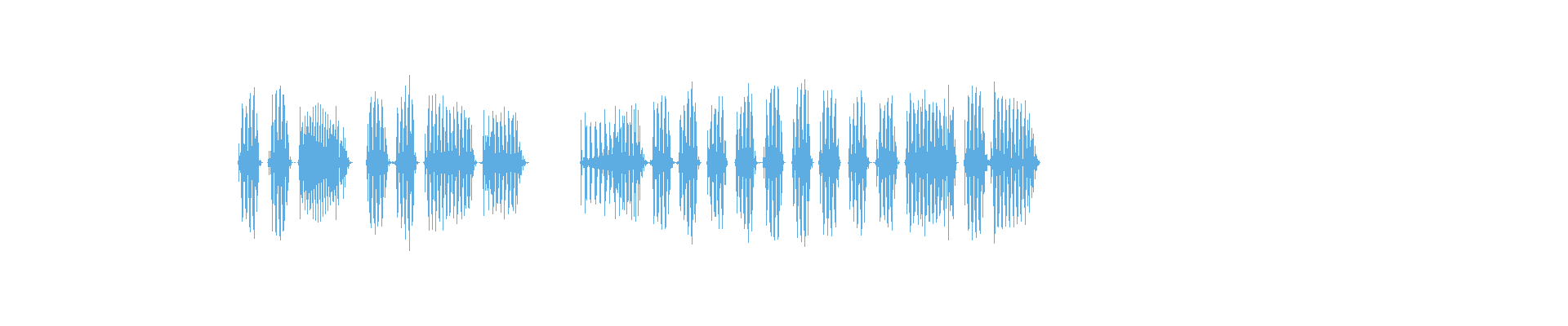 Waveform