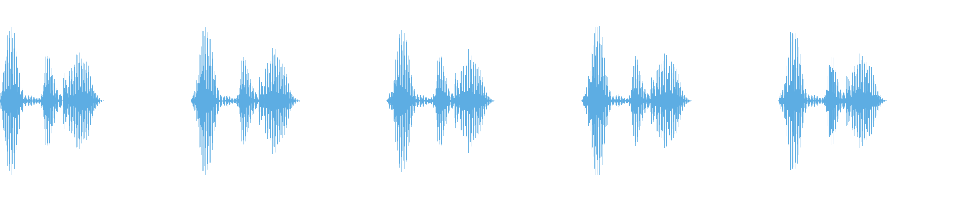 Waveform